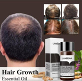 روغن و محلول تقویت مو بسیار قوی حجم ۲۰ میل