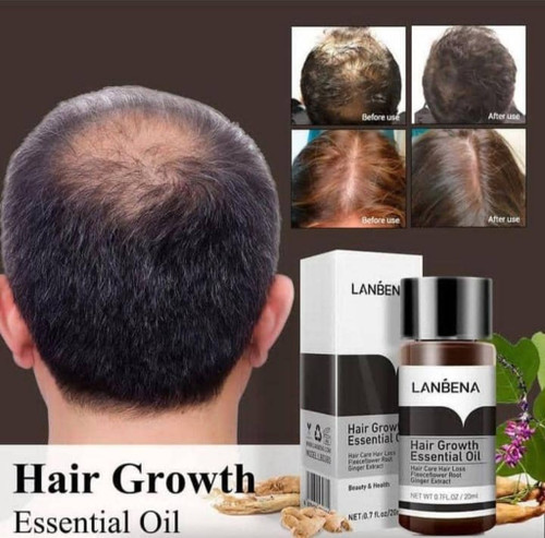 روغن و محلول تقویت مو بسیار قوی حجم ۲۰ میل