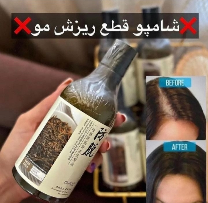 شامپو رزماری ضد ریزش قوی مو اصلی حجم ۲۵۰ میل