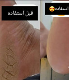 سوهان و رنده پا دوطرفه