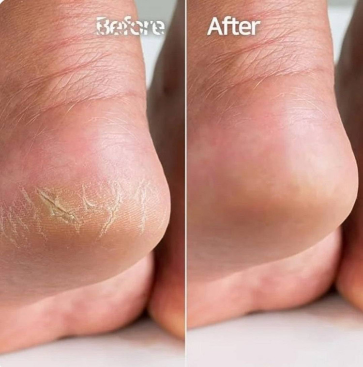 اسپری ترک پا و لایه بردار راکو اصلی حجم ۱۵۰ میل